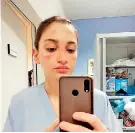  ??  ?? Nurse Alessia Bonari posted this picture of her bruised face after wearing a protective face mask for hours at work