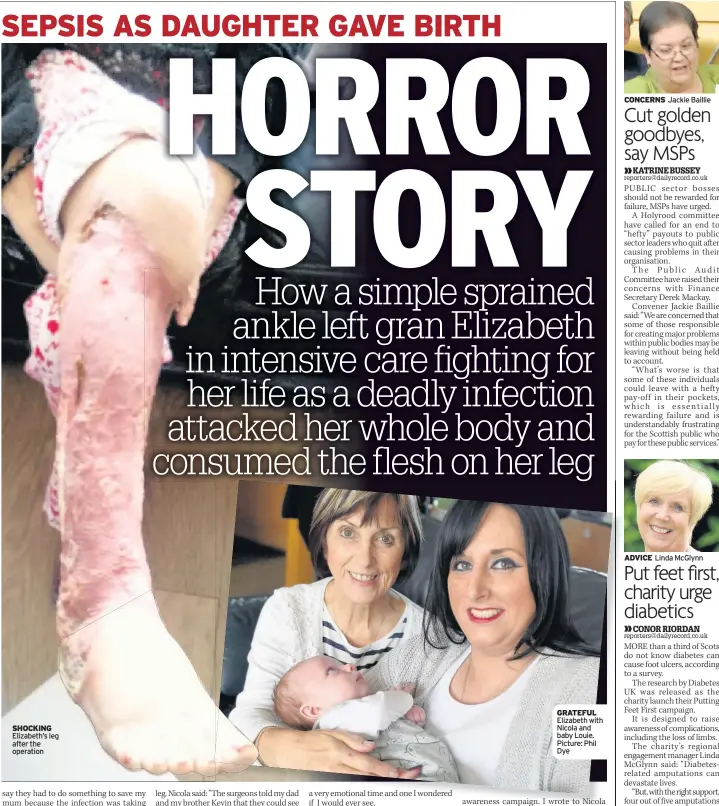  ??  ?? SHOCKING Elizabeth’s leg after the operation GRATEFUL Elizabeth with Nicola and baby Louie. Picture: Phil Dye CONCERNS Jackie Baillie ADVICE Linda McGlynn