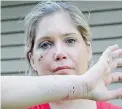  ??  ?? An attack by a feral cat Tuesday left realtor Bryn Erin Ward with injuries to her face and limbs.