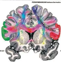  ??  ?? HEMISFERA kiri
PERKEMBANG­AN bahasa bermula di usia kanak-kanak.
HEMISFERA kanan
IMEJ aktiviti luar biasa di bahagian hemisfera kiri otak berbanding kanan
antara punca gagap disebabkan masalah dalam
fungsi otak.