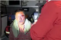  ?? ?? El hombre terminó con una delicada herida en la cabeza.