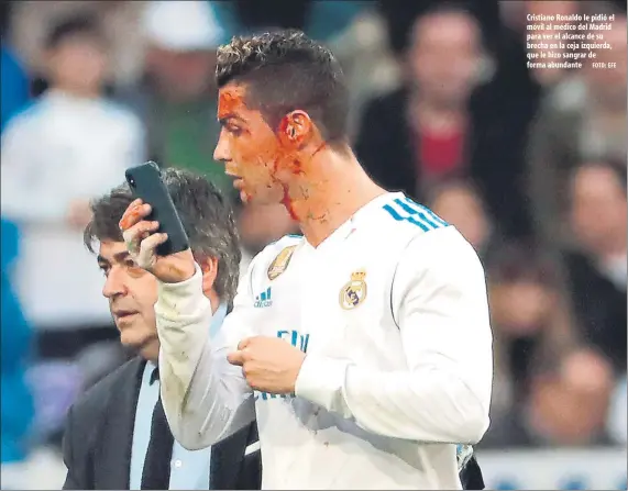  ?? FOTO: EFE ?? Cristiano Ronaldo le pidió el móvil al médico del Madrid para ver el alcance de su brecha en la ceja izquierda, que le hizo sangrar de forma abundante