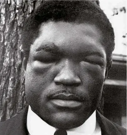  ?? Photo: HERB SCHARFMAN/ THE LIFE IMAGES COLLECTION/ GETTY IMAGES ?? PUNISHMENT: Terrell’s swollen face after WKH $OL ԴJKW