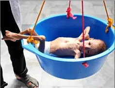  ??  ?? A Yemeni child suffering from malnutriti­on is weighed at a hospital in the district of Aslam in the northweste­rn Hajjah province. — AFP photo