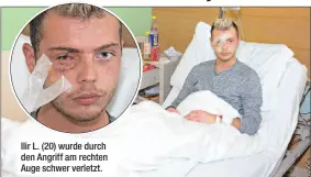  ??  ?? Ilir L. (20) wurde durch den Angriff am rechten Auge schwer verletzt.