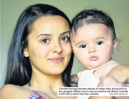  ?? RICHARD SWINGLER ?? Cherelle Farrugia became allergic to water after giving birth to her daughter Willow, who is now six months old. Below, Cherelle is left with a rash if she has a shower