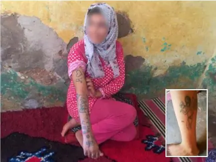  ?? FOTO'S AFP ?? Khadija Okkarou (17) toont de tatoeages op haar arm. Inzet: op haar been zijn een tatoeage en vermeende littekens van brandwonde­n van sigaretten te zien.