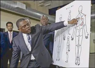  ?? AP ?? Pathologis­t Bennet Omalu presents a diagram showing the spots where police shooting victim Stephon Clark was struck by bullets during a news conference in Sacramento on Friday.