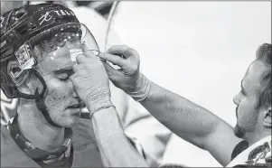  ?? CP PHOTO ?? Canada forward Alex Formenton has a patch removed from his forehead during practice Monday at the Sandman Centre in Kamloops, B.C.