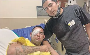  ?? Gonzalez f amily ?? WILLIAM GONZALEZ, 22, had his eye socket shattered by an LAPD projectile while celebratin­g the Lakers’ title win Sunday night and may lose his right eye. His brother Michael, right, dragged him from the chaos.