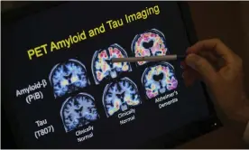  ?? Photograph: Evan Vucci/AP ?? The unusual approach to combating Alzheimer’s draws on the ability of light and sound waves to affect electrical activity in the brain.