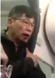  ??  ?? David Dao, 69, shortly after he was forcibly removed from his seat on a United Airlines flight in Chicago.