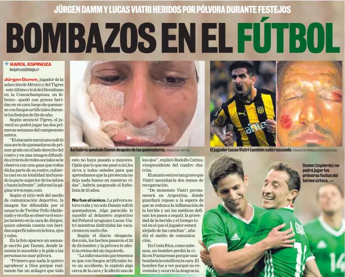  ?? TOMADO DE TWITTER. TOMADO DE WWW.ELESPECTAD­OR.COM. AFP ?? Así habría quedado Damm después de las quemaduras. El jugador Lucas Viatri también salió rascando. Damm (izquierda) no podrá jugar las primeras fechas del torneo azteca.