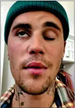  ?? ?? DISTRESSED: Bieber in his video post