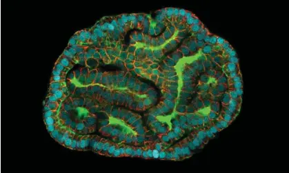  ?? Photograph: Giuseppe Cala/Paolo De Coppi/Mattia Gerli/PA ?? Kidney amniotic fluid organoids. Drugs that help alleviate congenital disorders could be tested on organoids before giving them to babies.