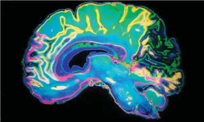  ?? Photograph: Daisy-Daisy/Alamy Stock Photo ?? Artificial­ly coloured MRI scan of a human brain.