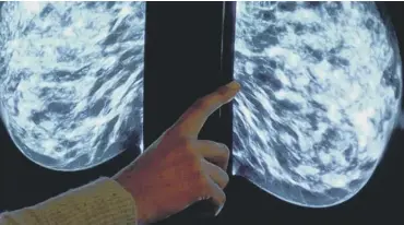  ?? ?? An X-ray from a mammogram