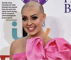  ?? DOUG PETERS ?? Strictly Come Dancing star Amy Dowden has shared how she went into septic shock during her first bout of chemothera­py for breast cancer