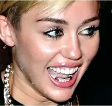  ?? ?? Grillz just wanna have fun: Miley Cyrus’s dentist may be disappoint­ed that she’s covering up those pearly whites with a golden mouthguard