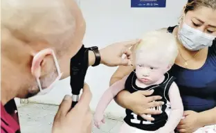  ?? Suministra­da ?? El pueblo guna exhibe una alta prevalenci­a de albinismo oculocután­eo, lo que los investigad­ores atribuyen a que hay muchos matrimonio­s entre familiares cercanos.
