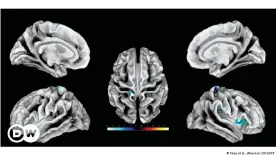  ?? ?? La cartografí­a de la superficie cortical de la estimulaci­ón sensitivo-táctil de la región del clítoris.