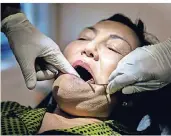  ??  ?? Um besser in den Zahnzwisch­enräumen bohren zu können, drückt ein Streichhol­z die Zähne dieser Patientin auseinande­r. In Deutschlan­d würde man dafür Interdenta­lkeile verwenden.