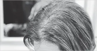  ?? ANNA DE SOUZA TNS ?? Many women start noticing thinning hair on top of their heads — the defining sign is a widening part.