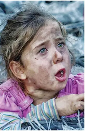  ??  ?? طفلة سورية مصابة نتيجة قصف قوات األسد على إدلب. (متداولة)