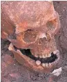  ??  ?? The skull of King Richard III. Photo: University of Leicester/PA Wire.
