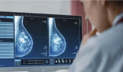  ?? © SHUTTERSTO­CK ?? Een dokter bekijkt een mammografi­e (röntgenfot­o van een borst).
