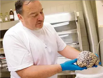  ?? Foto: Jakub Stadler, MAFRA ?? Lékaři Radoslav Matěj (nahoře) a Robert Rusina ukazují mozek člověka s neurodegen­erativním onemocnění­m a detail tkáně.