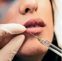  ?? SAM MOQADAM ?? Lip fillers for a luscious pout are popular with the 20 to 30 age bracket, Cosmetic Clinic Richmond owner Liz Woodward says.