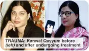  ?? ?? TRAUMA: Kanwal Qayyum before (left) and after undergoing treatment
