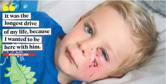  ?? YOUNG VICTIM: Jaxson Reddacliff, 4, in hospital after being bitten by his aunt’s labrador. Picture: ZIZI AVERILL ??