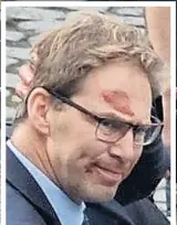  ??  ?? Bloodied MP Tobias Ellwood and, below in the main picture, standing in a suit watching over the police victim while yards away 999 crew treat the terrorist