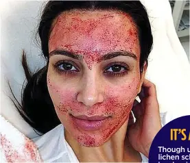  ?? ?? BLOOD LUST: Kim Kardashian after the plasma facial