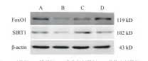  ??  ?? 注：A.正常组；B.模型组；C.药物低剂量组；D.药物高剂量组图4各组­小鼠肝组织 FoxO1 和 SIRT1蛋白表达免­疫印迹电泳图