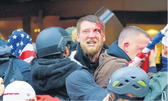  ?? JESSICA GRIFFIN/THE PHILADELPH­IA INQUIRER ?? A rioter with a head injury while trying to push past police through the doorway of the U.S. Capitol last week in Washington.