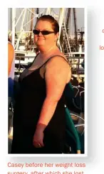  ??  ?? Casey before her weight loss surgery, after which she lost 160 pounds