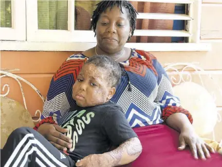  ?? (Photos: Garfield Robinson) ?? Five-year-old Jamaari Smith was diagnosed with a rare skin disease called pyoderma gangrenosu­m in June 2022 — a condition that causes large, painful sores to develop on the skin, most often the legs.