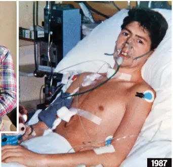  ??  ?? Vital procedure: Mr hayman underwent the heart transplant when he was 20