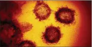  ?? Niaid-rml/Zuma press/tns ?? an image from an electron microscope shows sars-coV-2, the virus that causes coVid-19.