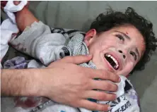  ??  ?? Injured: A Syrian child in eastern Ghouta yesterday