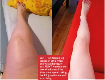  ??  ?? LEFT: How Nadja’s leg looked in 2013 when she was at her heaviest. RIGHT: How it looks now thanks to all the time she’s spent cutting her kilojoule intake and exercising.