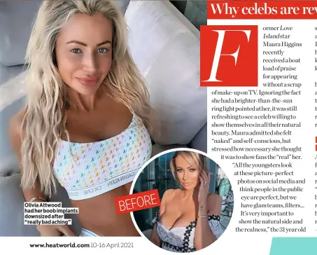  ??  ?? Olivia Attwood had her boob implants downsized after “really bad aching”
