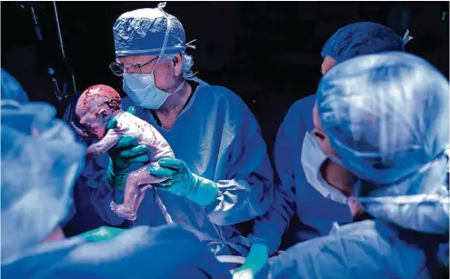  ??  ?? Ärzte der Baylor Universitä­t in Dallas entbinden einen Jungen nach der Gebärmutte­r-Transplant­ation.