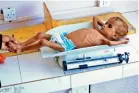 ??  ?? Un enfant yéménite souffrant de malnutriti­on pesé dans un hôpital de la capitale yéménite Sanaa, le 6 octobre 2018
