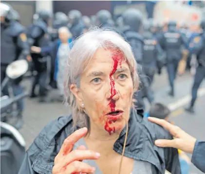  ?? CEZARO DE LUCA ?? Sangre. María José Molina Ferrer a la salida de la escuela en donde esperaba votar ayer.