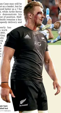  ?? GETTY IMAGES ?? All Blacks captain Sam Cane was bloodied but unbowed.