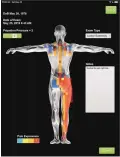  ??  ?? An screen of a PainScan done on a patient with sciatica-like complaint.